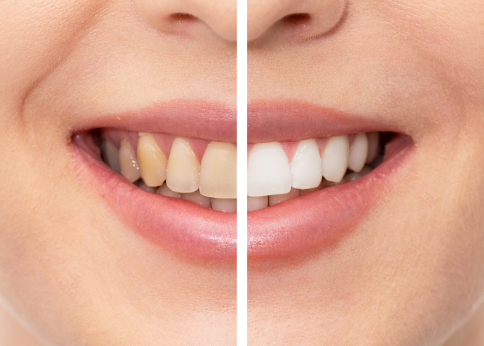 Design sem nome (21)