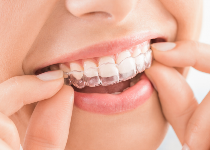 Design sem nome (22)